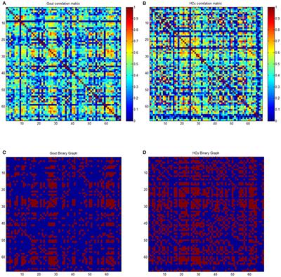 Gout Is Not Just Arthritis: Abnormal Cortical Thickness and Structural Covariance Networks in Gout